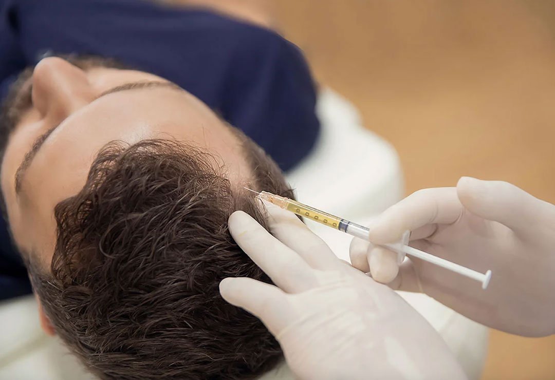 Dr Mehdi Lahbabi - Traitements PRP et PRF