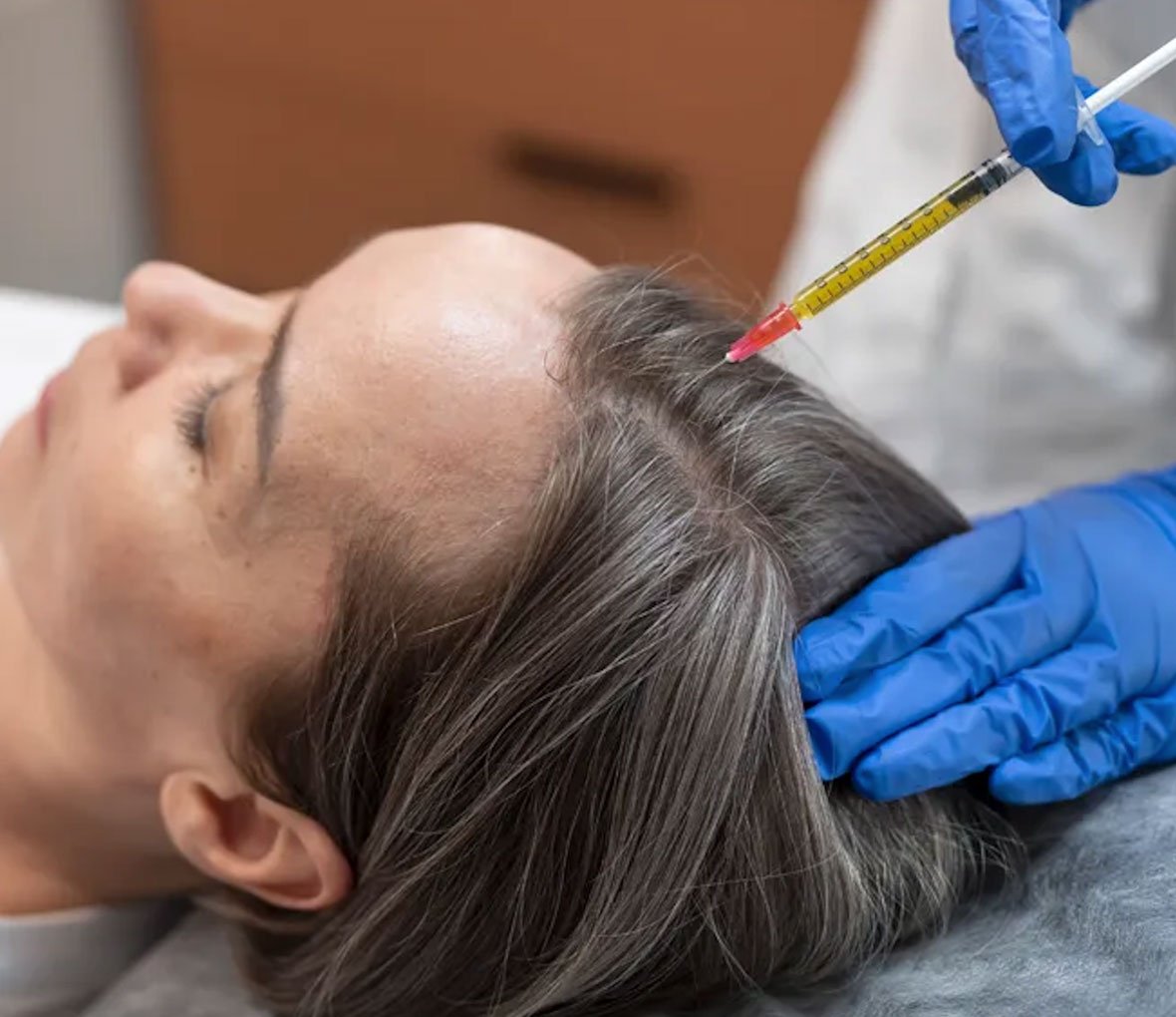 Dr Mehdi Lahbabi - Traitements PRP et PRF
