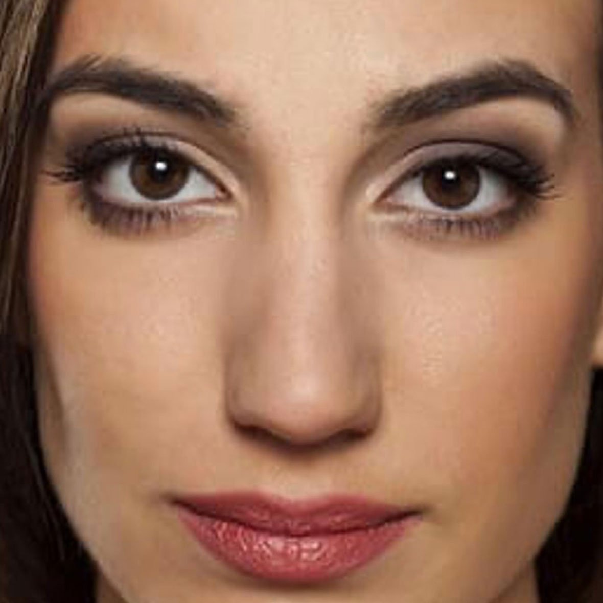 Dr Mehdi Lahbabi - Hydrafacial - Après