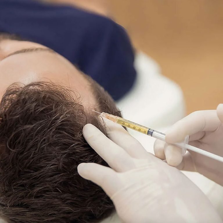 Dr Mehdi Lahbabi - Traitements PRP et PRF